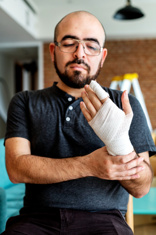 a man holding his burn injuries on his hand
